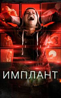 Имплант