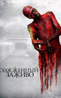 Сожженный заживо